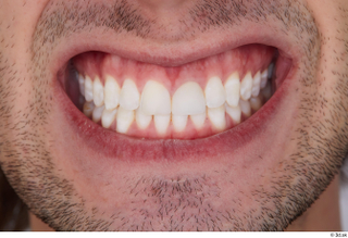 Chadwick teeth 0001.jpg